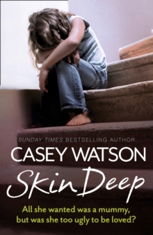 Skin Deep : All She Wanted Was a Mummy, but Was She Too Ugly to be Loved?, Paperback Skin Deep : All She Wanted Was a Mummy, but Was She Too Ugly to be Loved?, Paperback