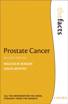 Prostate Cancer, Paperback Book Prostate Cancer, Paperback Book