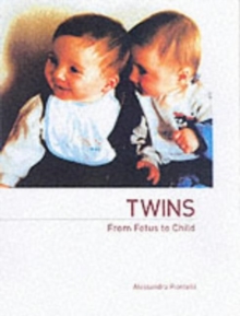 Twins : From Fetus to Child, Paperback Twins : From Fetus to Child, Paperback