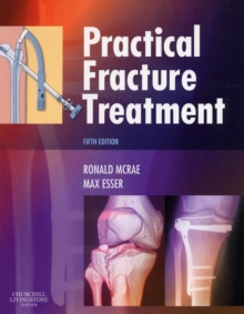 Practical Fracture Treatment, Paperback Book Practical Fracture Treatment, Paperback Book