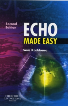 Echo Made Easy, Paperback Book Echo Made Easy, Paperback Book