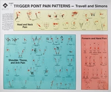 Trigger Point Pain Patterns Wall Charts, Wallchart Trigger Point Pain Patterns Wall Charts, Wallchart