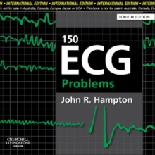 150 ECG Problems, Paperback Book 150 ECG Problems, Paperback Book