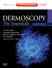 Dermoscopy: the Essentials: Expert Consult - Online and Print, 2e, Paperback Book Dermoscopy: the Essentials: Expert Consult - Online and Print, 2e, Paperback Book