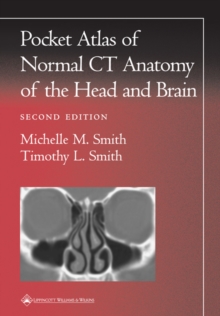Pocket Atlas of Normal CT Anatomy of the Head and Brain, Paperback Book Pocket Atlas of Normal CT Anatomy of the Head and Brain, Paperback Book