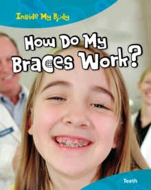 How Do My Braces Work?, Paperback Book How Do My Braces Work?, Paperback Book