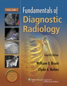 Fundamentals of Diagnostic Radiology - 4 Volume Set, Paperback Book Fundamentals of Diagnostic Radiology - 4 Volume Set, Paperback Book