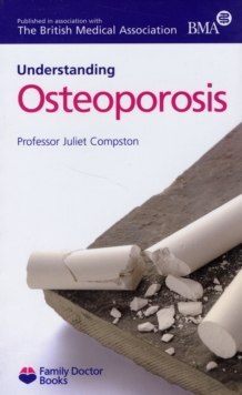 Understanding Osteoporosis, Paperback Book Understanding Osteoporosis, Paperback Book
