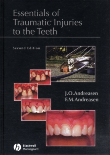 Essentials of traumatic injuries to the teeth, 2nd Edition