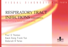 Visual Diagnosis Self-Tests in Respiratory Tract Infection