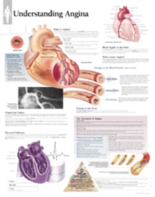 Understanding Angina