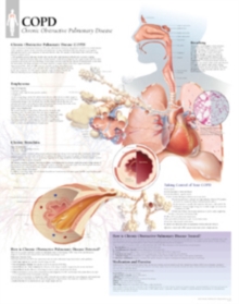 COPD (Chronic Obstructive Pulmonary Disease)