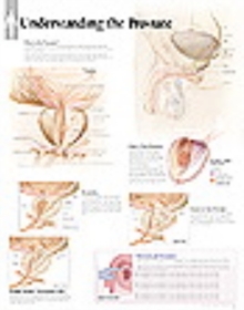 Understanding the Prostate