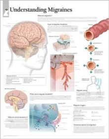 Understanding Migraines
