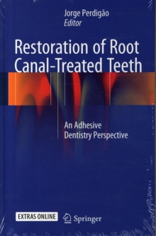 Restoration of Root Canal-Treated Teeth