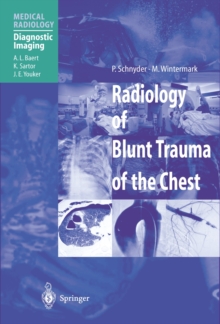 Radiology of Blunt Trauma of the Chest